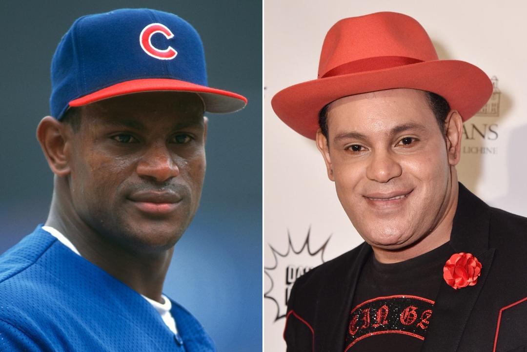 Sammy Sosa: ¿Quién es estrella de la MLB que blanqueó su color de piel?