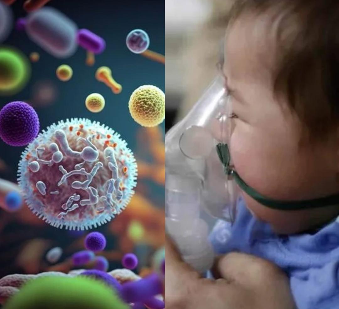 Virus Sincitial Respiratorio: Jalisco emite medidas para prevenir casos