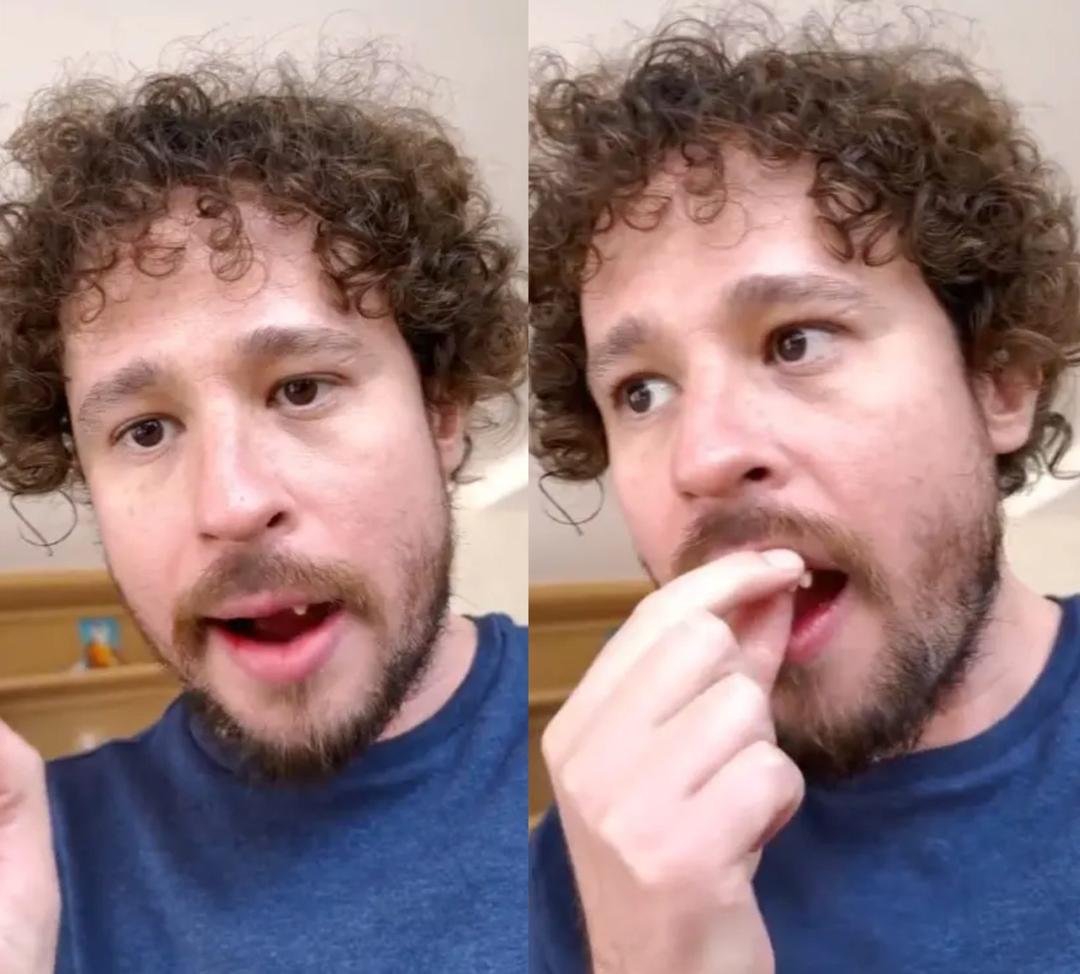 VIDEO | Luisito Comunica se hace viral por salir en un video donde se le caen los dientes