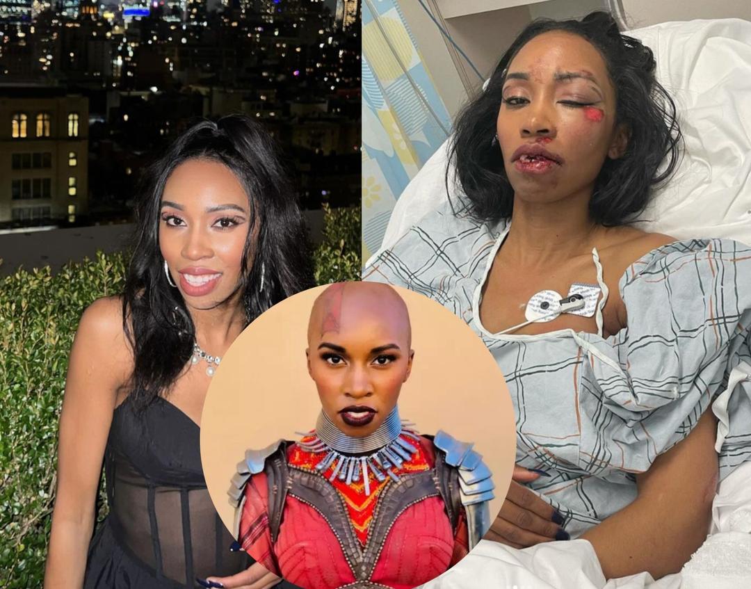 Carrie Bernans, actriz de Marvel es atropellada en Nueva York en año nuevo