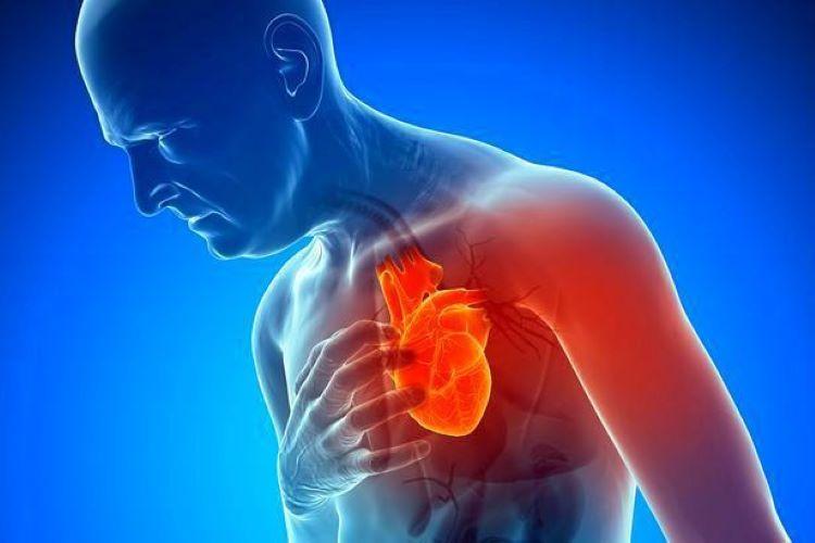Infarto fulminante: ¿Qué es y por qué da este padecimiento?