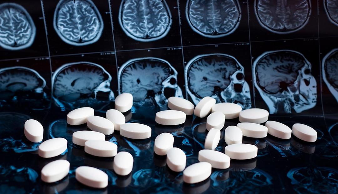 Alzhéimer: Estados Unidos aprueba medicina de Eli Lilly para tratar la enfermedad