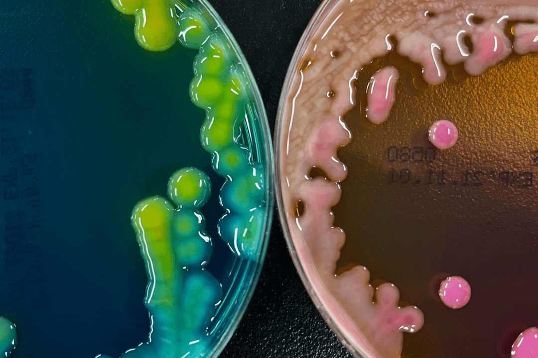 Klebsiella Oxytoca: Suman 17 menores muertos por bacteria