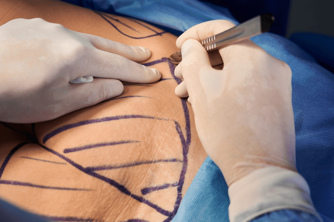 Guadalajara: Médico cirujano estético es vinculado a proceso por homicidio culposo