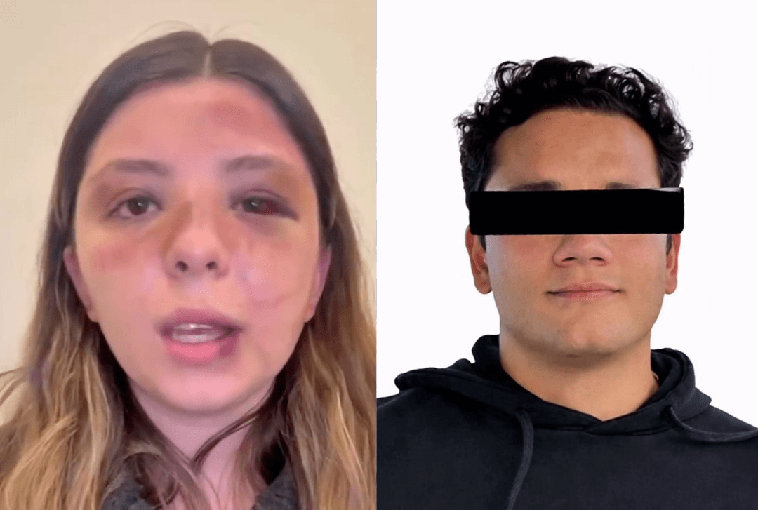 Ana Caterina Marino: Joven es brutalmente golpeada por su novio