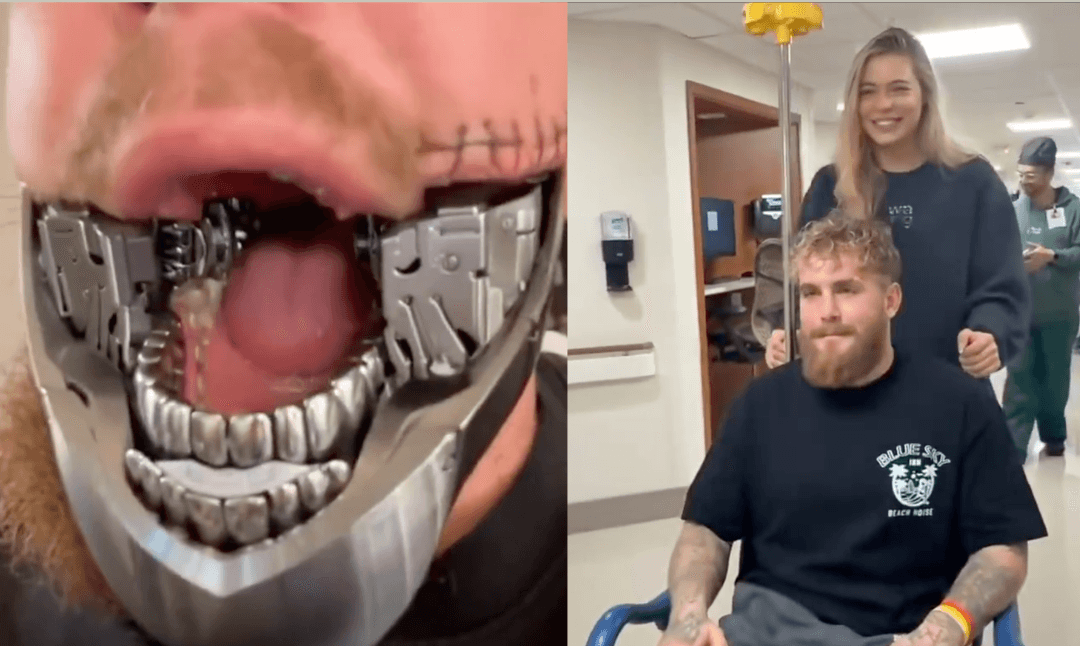 Jake Paul se somete a nueva cirugía de mandíbula tras paliza de Anthony Joshua