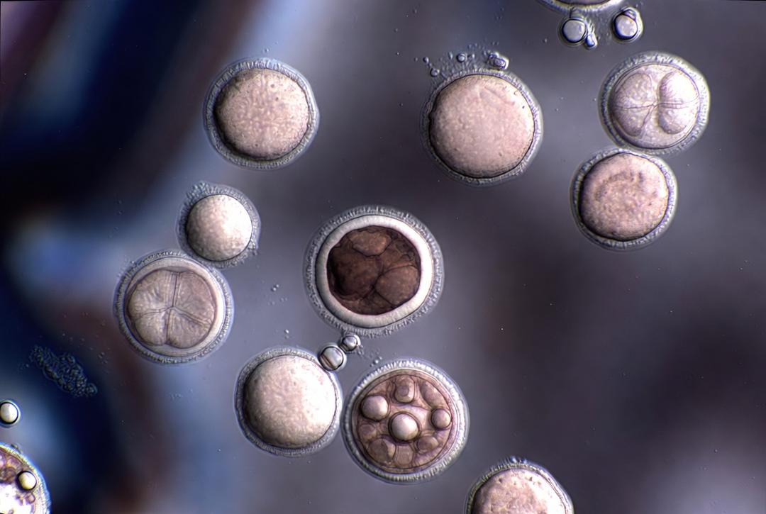 Brote de ciclosporiasis: EU registra infección por parásito transmitido por alimentos