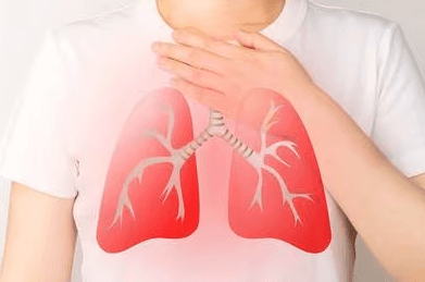 Virus Sincicial: ¿Cuáles son los síntomas de esta enfermedad respiratoria?