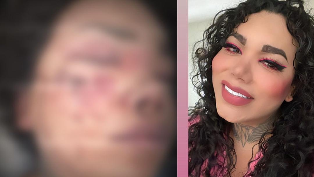 Paolita Suárez, amiga de Wendy, ingresa al hospital con graves golpes en la cara