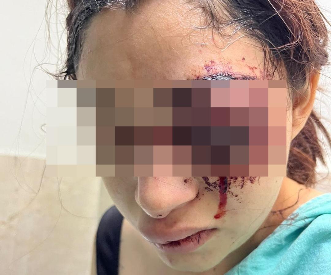 Tamaulipas: Jovencita es agredida a golpes por su novio