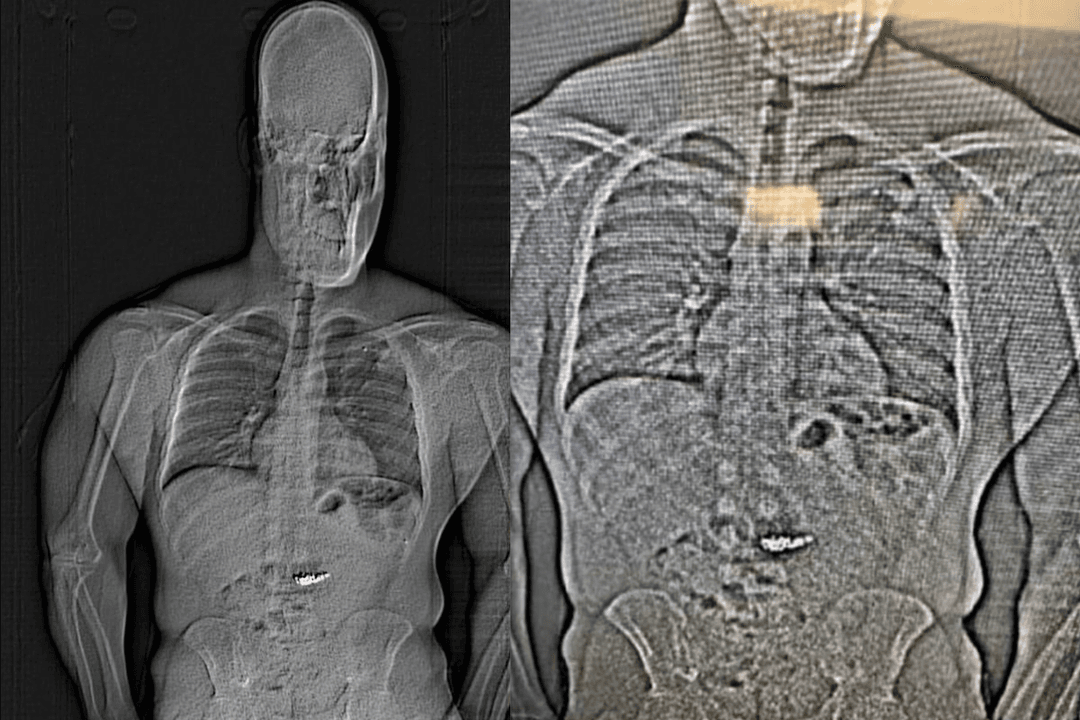 VIRAL: Ladrón se traga aretes de diamante para evitar arresto