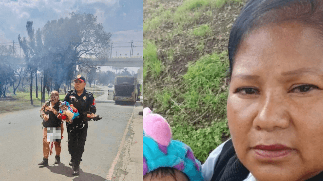 Iztapalapa: Bebé recibe injertos de piel tras explosión de pipa