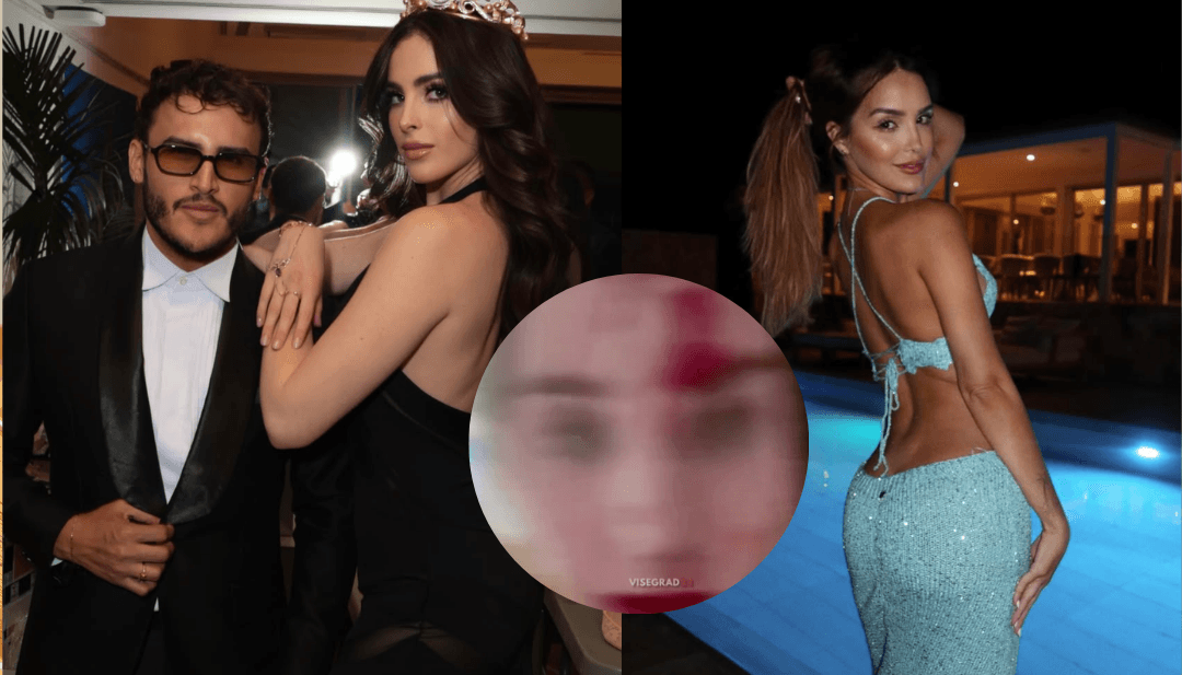 Giovanni Laguna: Maquillista de Fátima Bosch es acusado de golpear a Miss Venezuela Global