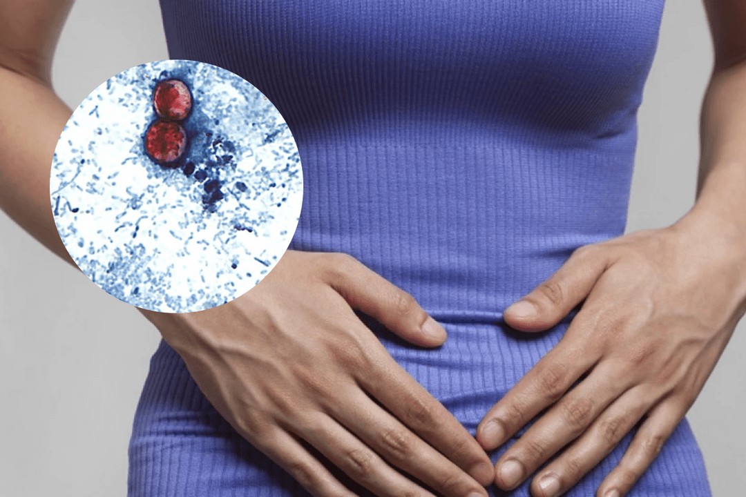 Diarrea explosiva en México: Salud confirma 33 casos por ciclosporiasis