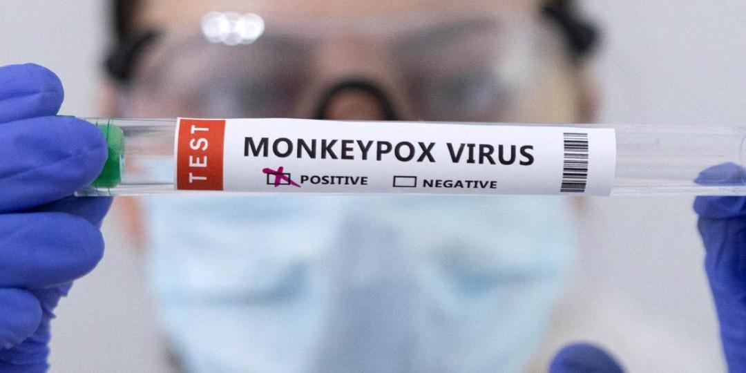 Francia confirma el primer caso del virus Shamnoda en humanos